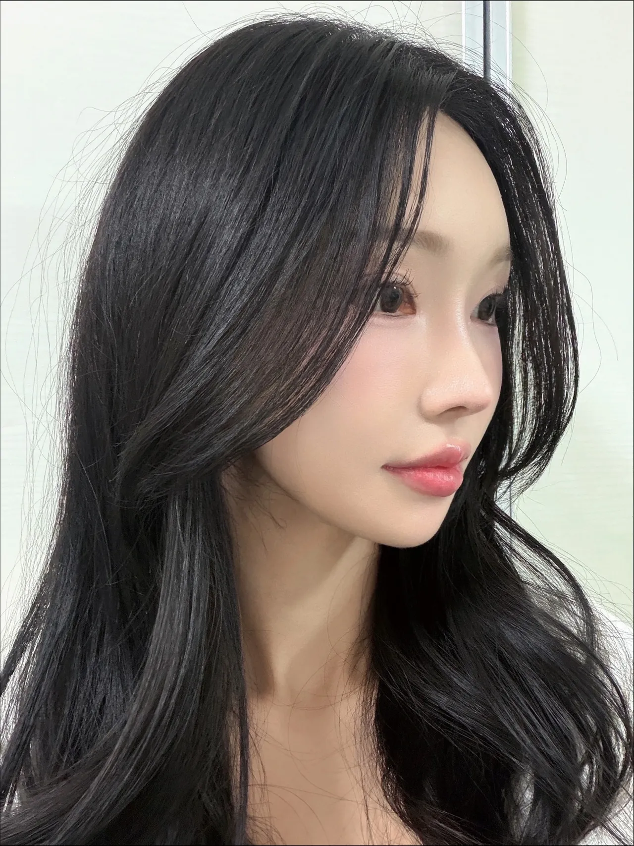Rhinoplasty Revision — Luho Plastic Surgery 6