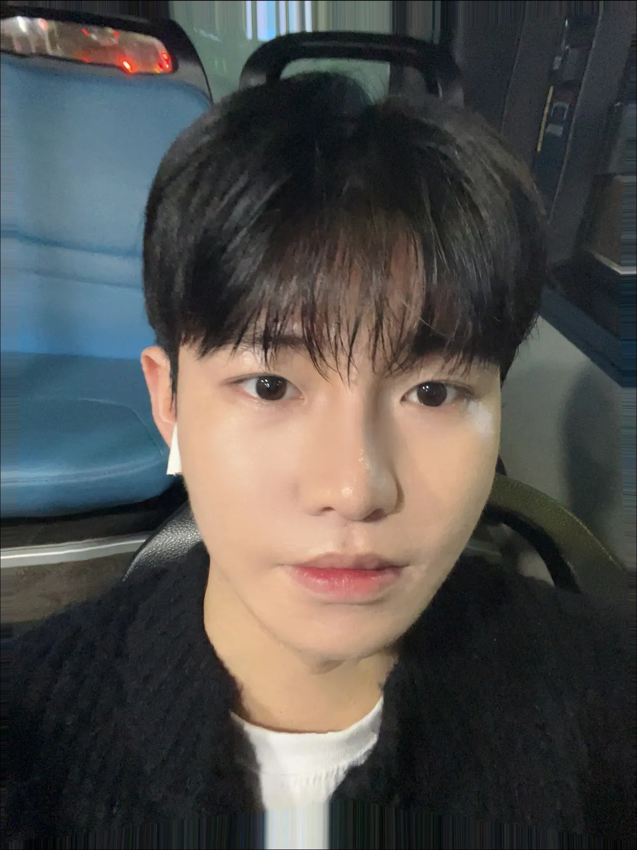 Natural Adhesion Double Eyelid Surgery, Ptosis Correction, Men’s eye surgery — Luho Plastic Surgery 4