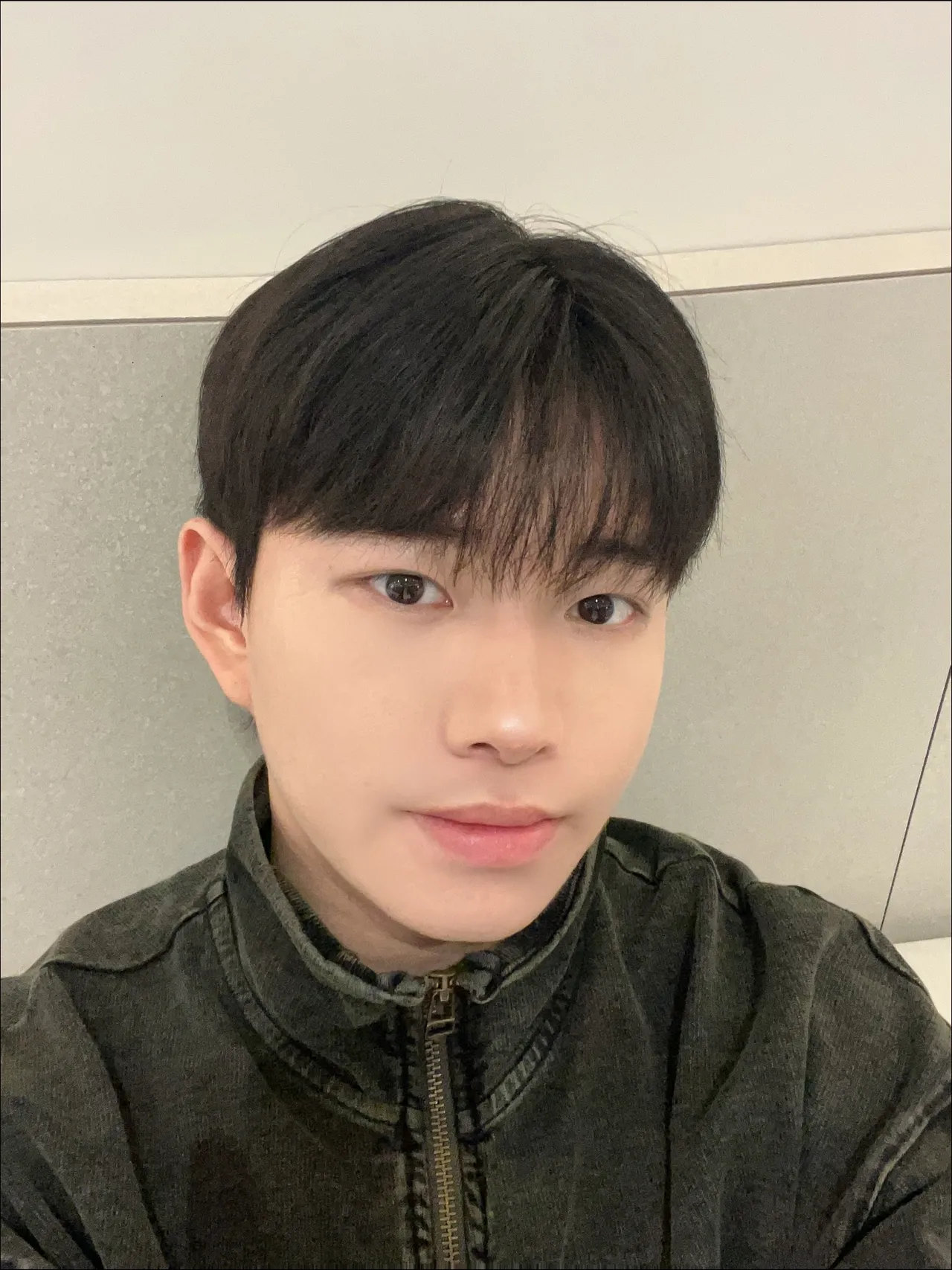 Natural Adhesion Double Eyelid Surgery, Ptosis Correction, Men’s eye surgery — Luho Plastic Surgery 5