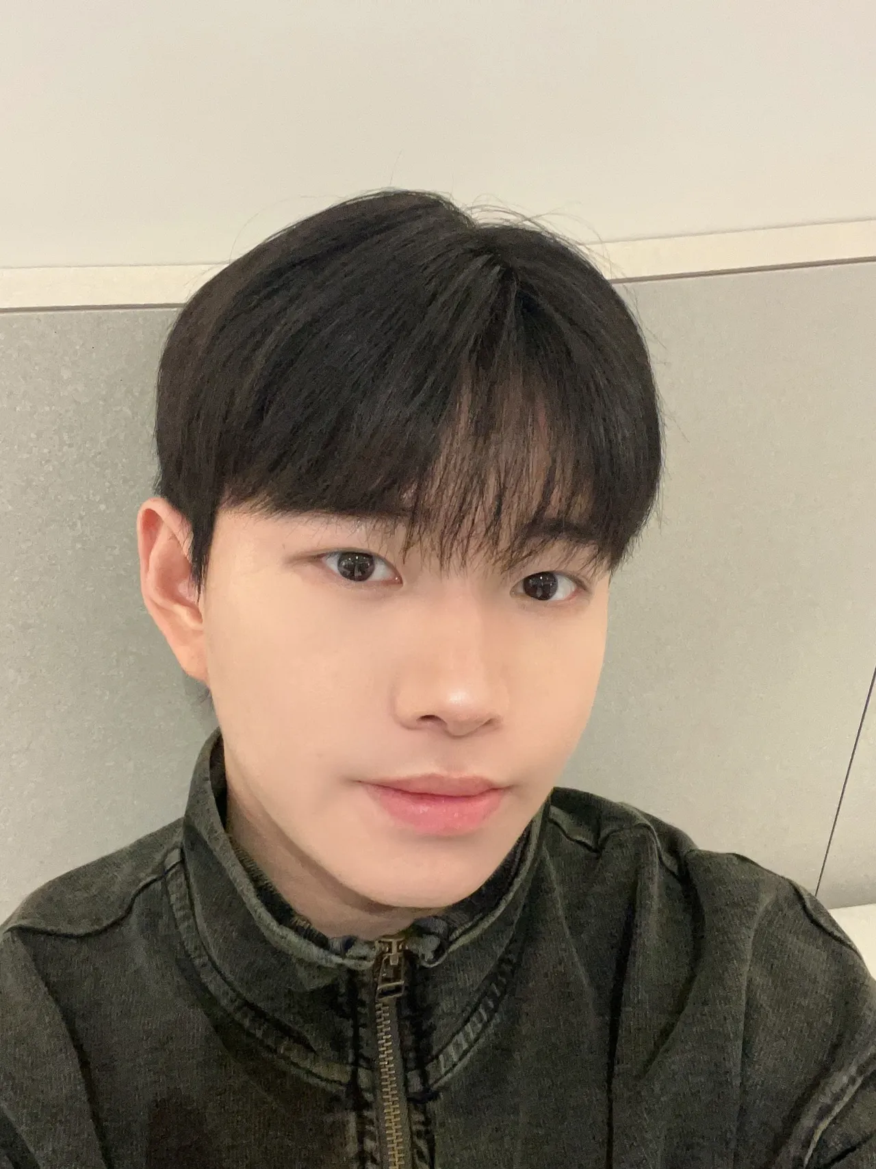 Natural Adhesion Double Eyelid Surgery, Ptosis Correction, Men’s eye surgery — Luho Plastic Surgery 6