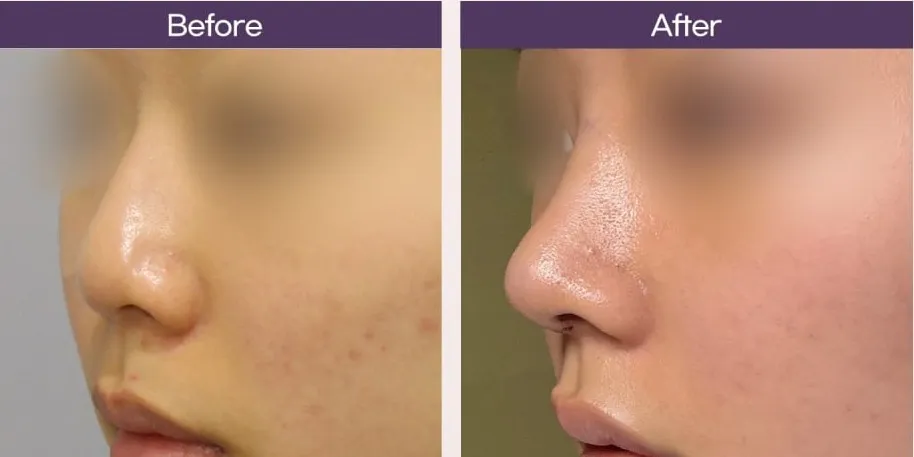 DOY JUN Plastic Surgery 3